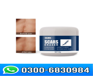 Eelhoe Scar Eraser Cream Price in Pakistan